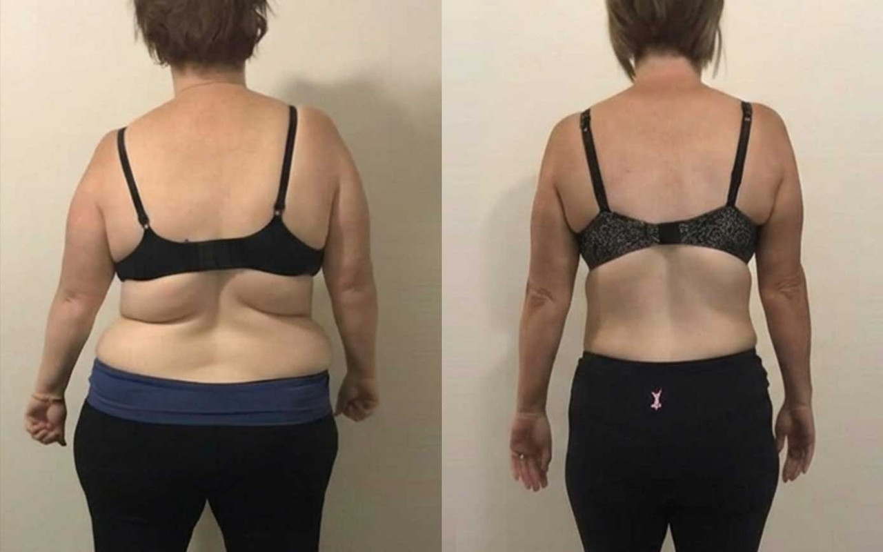 Inflammation reduction